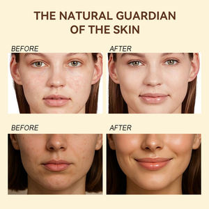 <b>玻尿酸补水保湿面霜50g（型号HF-CRM50A）</b>